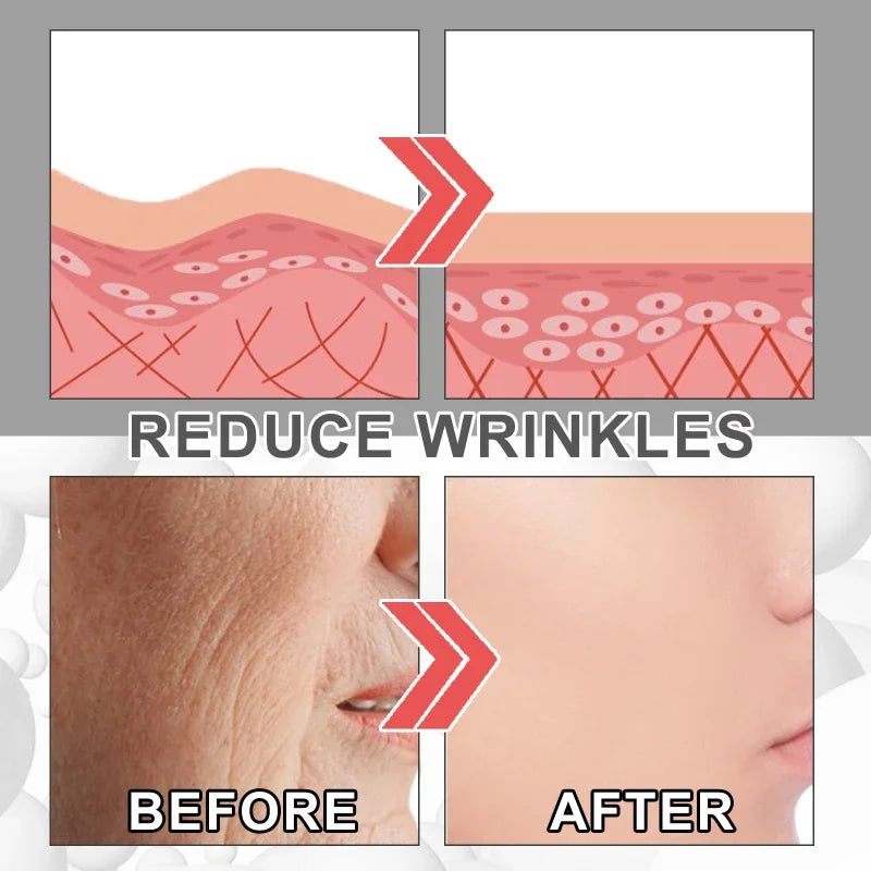 30ml Collagen Boost Serum Anti-Aging Dark Spot Corrector Anti-wrinkle Face Cream Fade Fine Lines Korean Skin Care Cosmetics