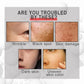 30ml Collagen Boost Serum Anti-Aging Dark Spot Corrector Anti-wrinkle Face Cream Fade Fine Lines Korean Skin Care Cosmetics